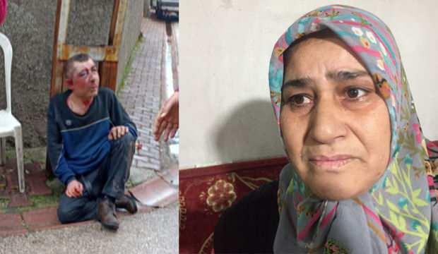 Adana’da öldüresiye dövüp evinin önüne bıraktılar, eşi tanıyamadı 