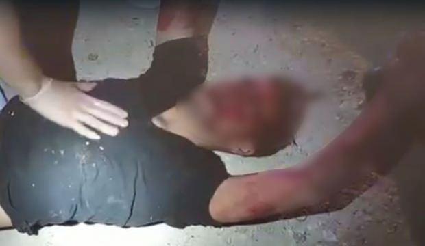 Niğde'de akılalmaz olay! Polis memurlarını darp edip kurşunladılar