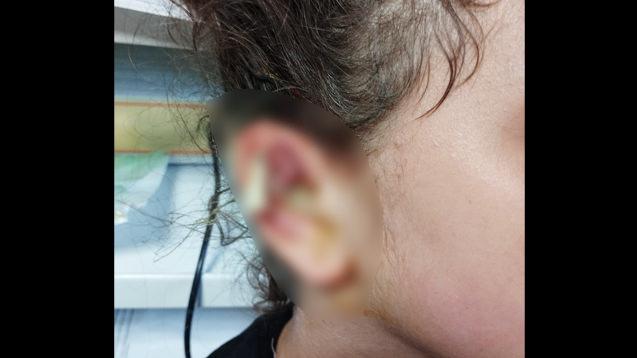 Kocaeli kulak enfeksiyonu