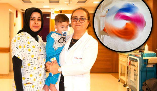 Gaziantep’te 1 yaşındaki bebeğin midesinden çıkanlar hayrete düşürdü