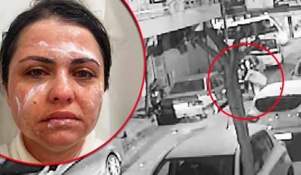 İstanbul’da eski koca vahşeti: Boşandığı kadına kimyasal maddeyle saldırdı