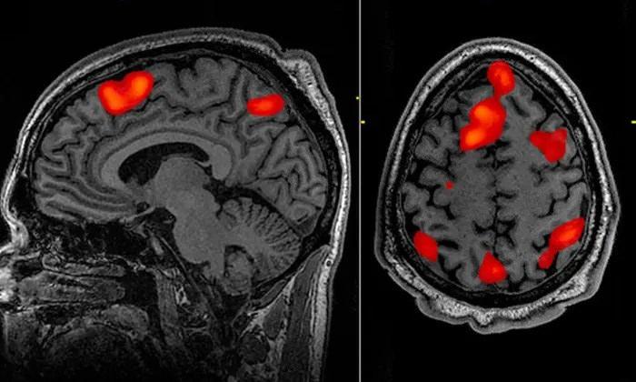 fMRI cihazı ile elde edilen beyin aktivitesi görüntüsü | Fotoğraf: John Graner