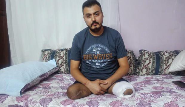 Yok böyle acı! Eşi, iki çocuğu ve iki bacağını kaybetti