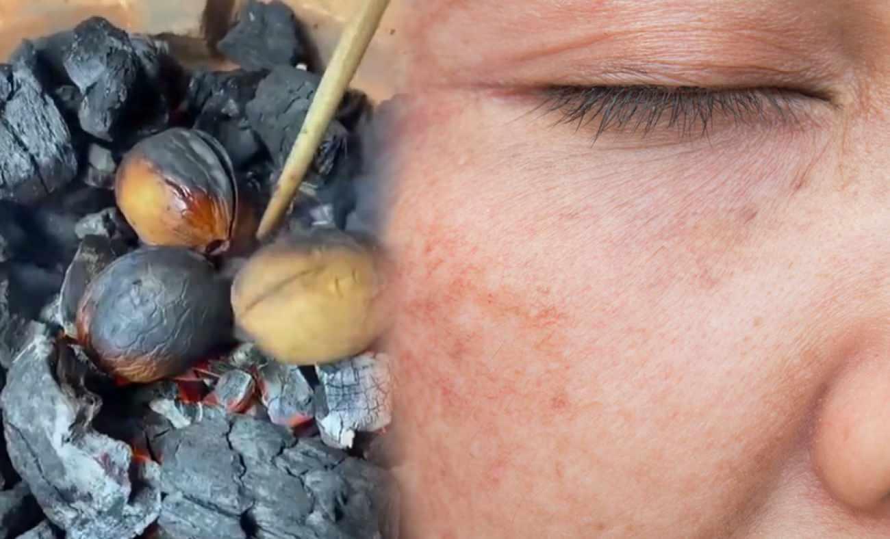 Yüzünüzdeki lekeleri ve yanık izlerini gideren cevizli zeytinyağı karışımı!