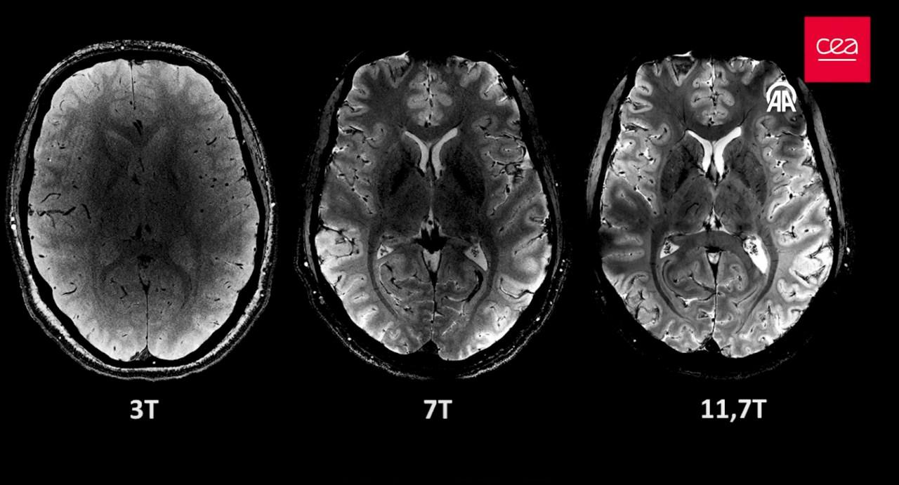 Dnyann en byk MRI cihazyla ekildi: nsan beyni ilk kez bu kadar net grntlendi...