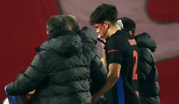 Devler Ligi'nde korkutan anlar! Genç yıldız kanlar içinde kaldı