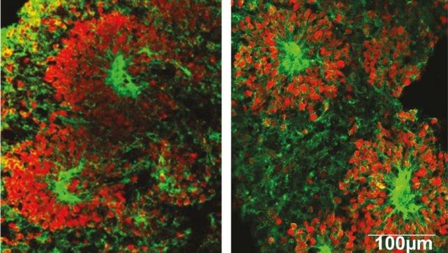Yerde (solda) ve uzayda yaşayan organoidlerde (sağda) görülen kortikal organoidlere özgü nöral rozetler. Her ikisi de sağlıklı hücreler yetiştirdi.