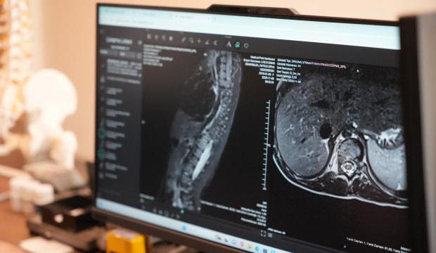 Anneler dikkat! Bu hastalığı ilk siz fark ediyorsunuz