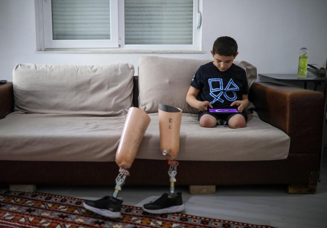 Aras Çelik'r protez bacakların küçük gelmeye başladı. 