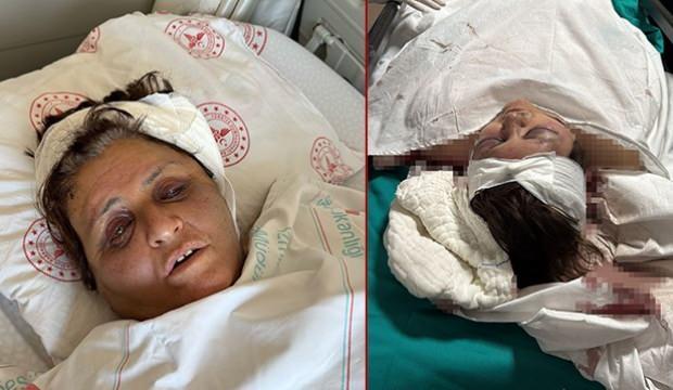 Yufka  meselesi nedeniyle gelini tarafından komalık edildiği iddia edilen kadın uyandı!