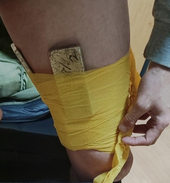 Kütçe altınlar bant yardımıyla vücudunun çeşitli bölümlerine yapıştırılmış halde bulundu. 