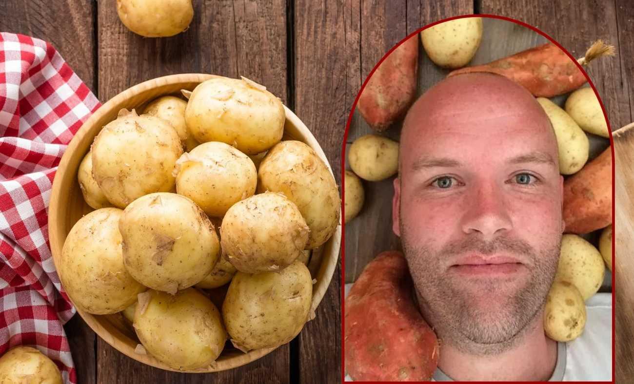 150 kilonun üzerindeydi: 1 yıl boyunca sadece patates yedi! Sonucu herkesi şaşırttı