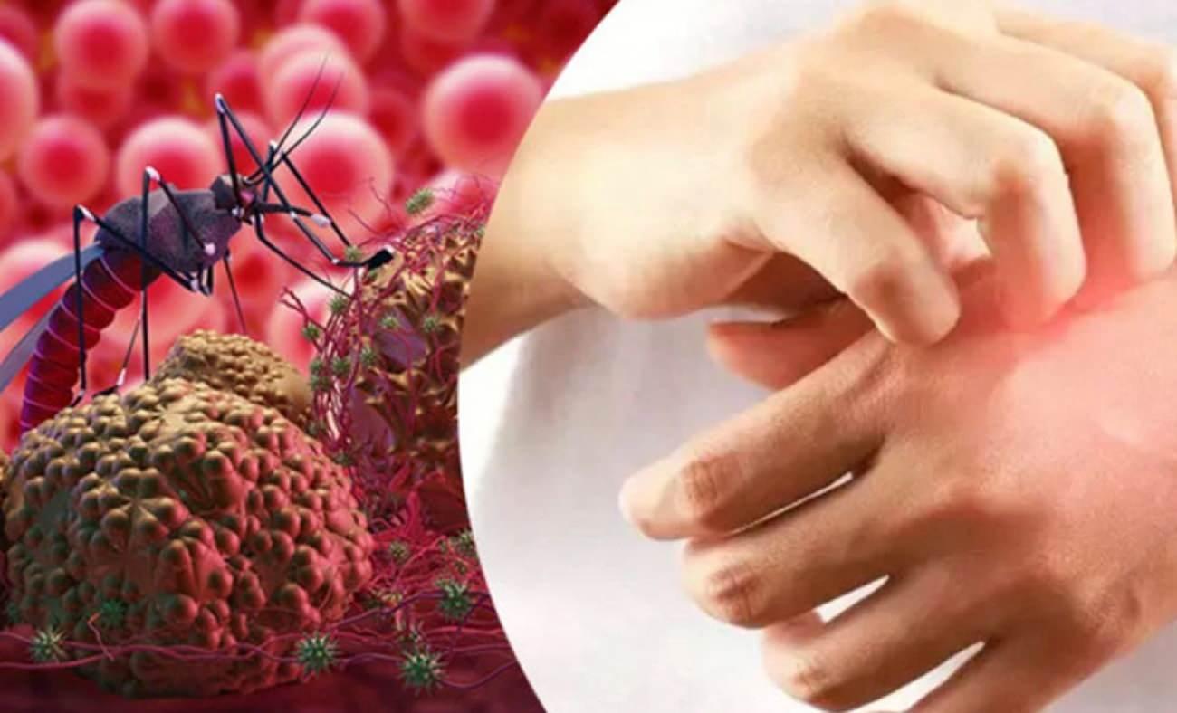 Seyahat edenler dikkat! Yüksek ateşle başlayıp ölüme neden olan tehlike: Sıtma