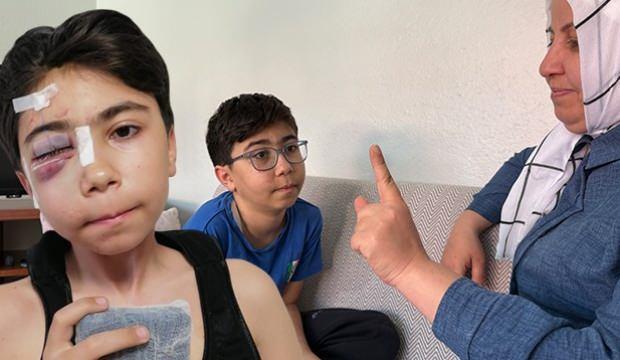 13 yaşındaki çocuk geçirdiği kazanın ardından çift görmeye başladı