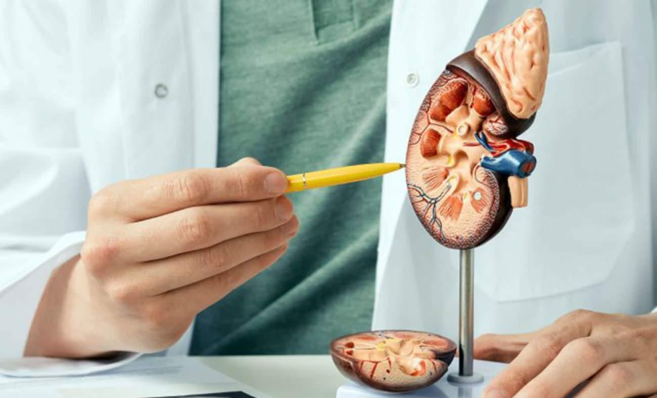 Her 8 kişiden birinde görülüyor! Böbrek taşıyla hayatınız kabusa dönmesin