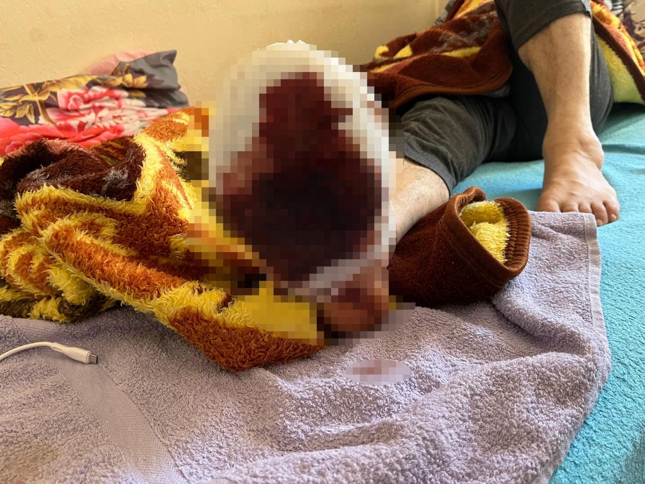 Aylardır açık yarayla yaşamaya çalışıyor. 