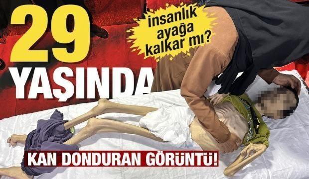 İsrail, açlık silahına sarıldı, genç, yaşlı dinlemeden katlediyor! 