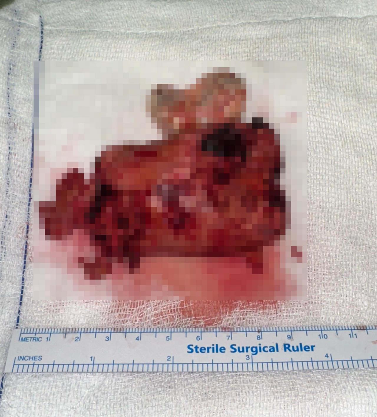  Ağırlığı 250 gram, uzunluğu 10 santim olan kitle.