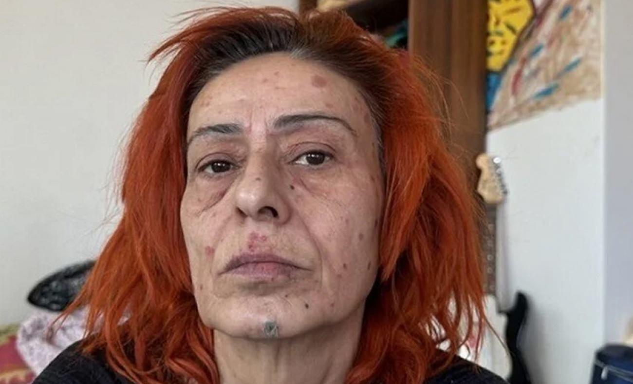 Yıldız Tilbe ilk kez hastalığını açıkladı! Doktorundan yasak üstüne yasak