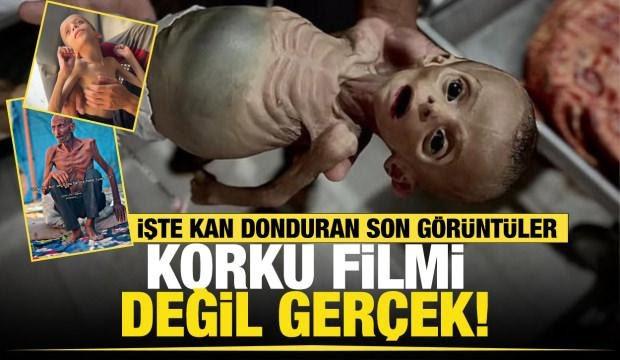 İnsanlık Gazze'de sınıfta kaldı! Açlıktan ölenlerin yarısından fazlası çocuk!