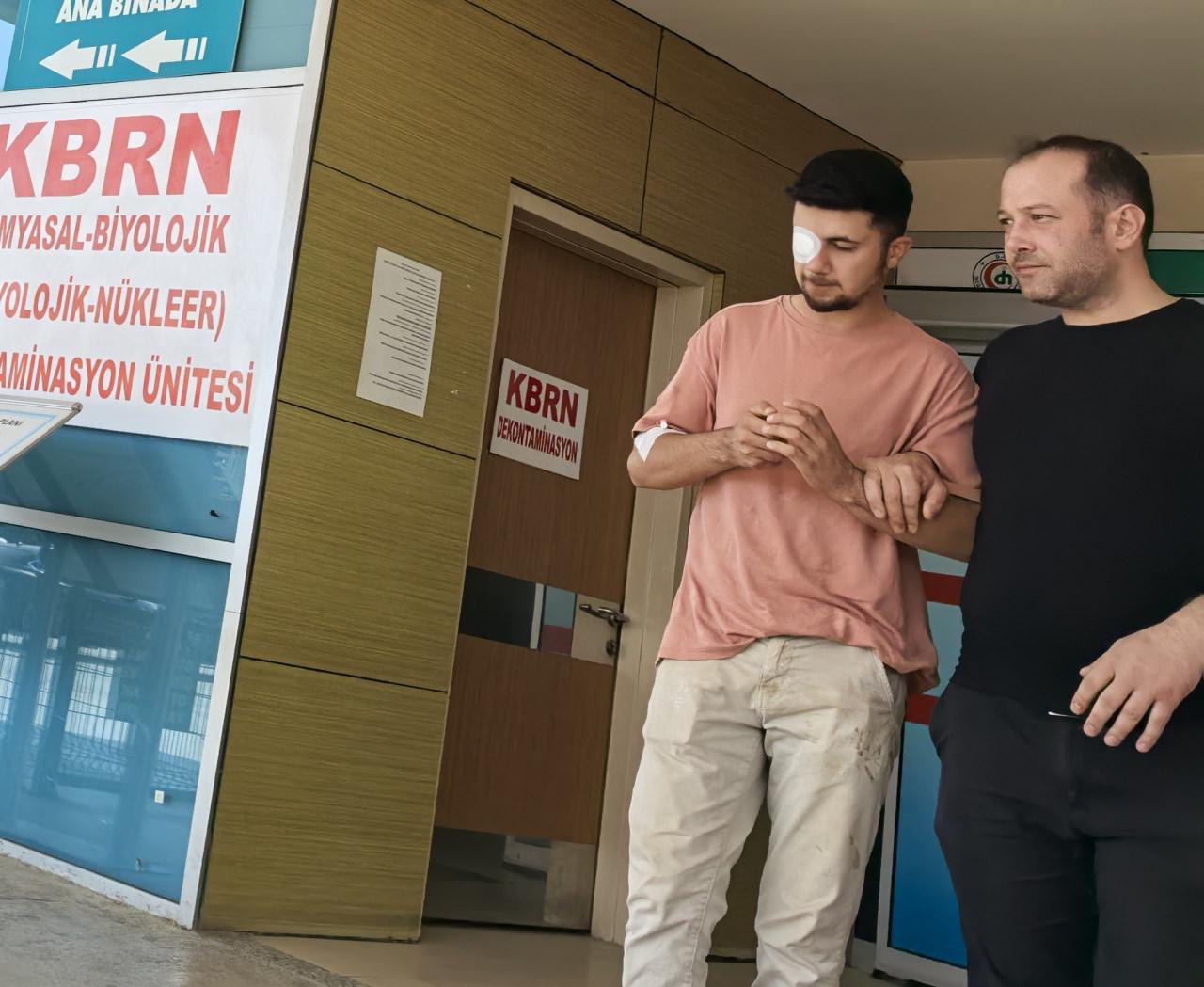 Gözüne çivi saplanan adam, hastaneye kaldırıldı. 