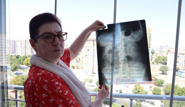 Ameliyat skandalı! 22 yıldır canlı bomba gibi geziyor