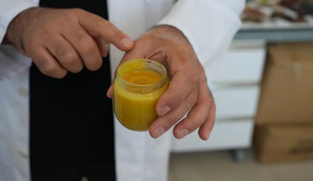 Türkiye'de geliştirildi! Cilt kanserine karşı etkili krem üretildi