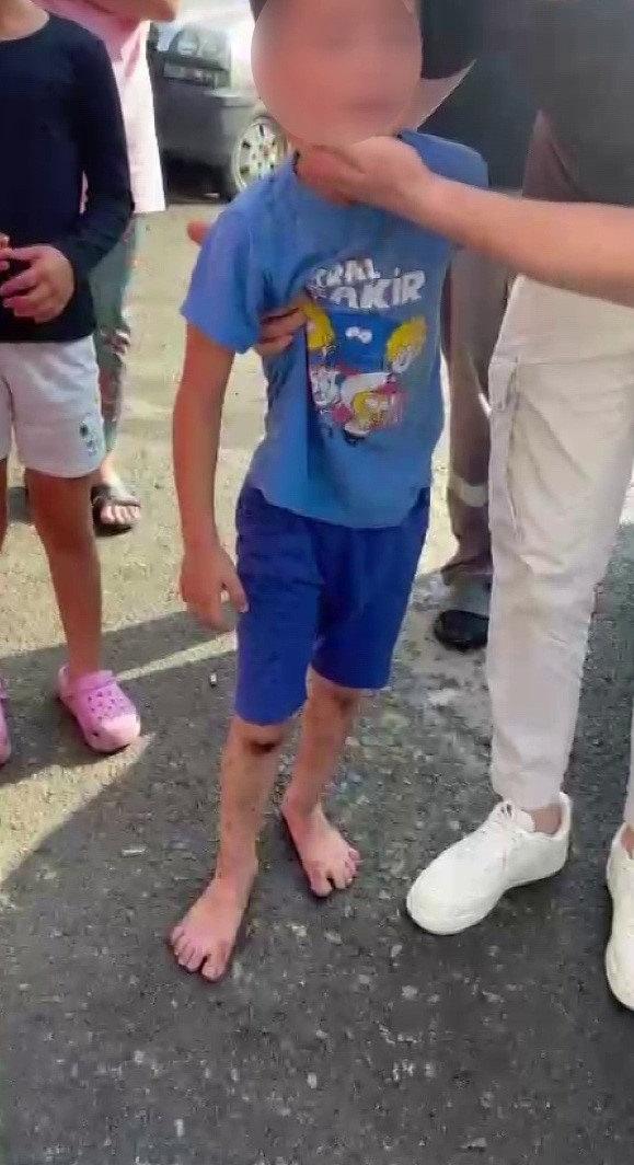  6 yaşındaki Umut Çakır, saldırı sonrası hastaneye götürüldü. 