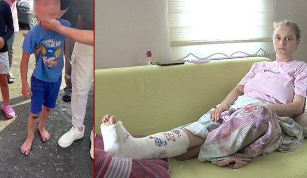 Beykoz'da köpek dehşeti! Çocuk yaralı, kadın sakat