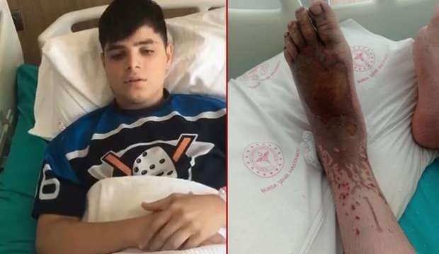 14 yaşındaki Turan, asit çamuruna bastı! Korkunç iddia...