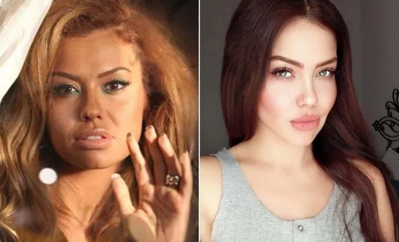 Beynimde kitle belirlendi demişti: Ünlü şarkıcı Lara son halini paylaştı!