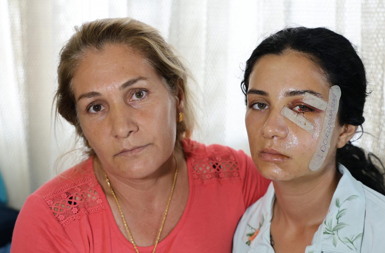 Annesine 'Öldürdü bu beni.' diyerek mesaj attı.