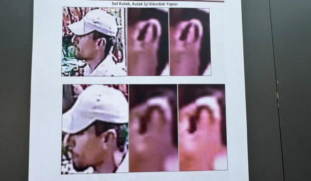 Kulağı 8 yıl sonra gerçeği ortaya çıkardı! 17 milyon lira tazminat başvurusu