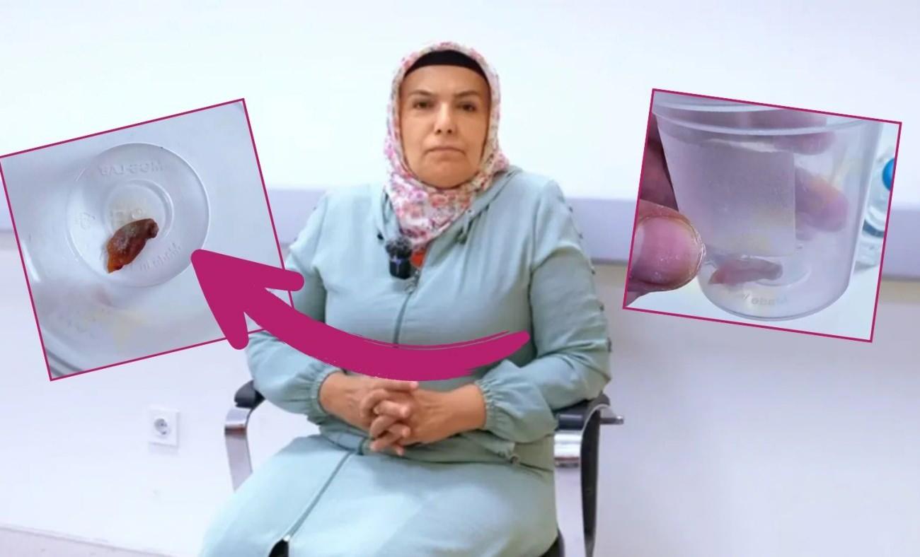 1,5 yıldır durmadan öksüren kadının boğazından çıkan herkesi şoke etti!