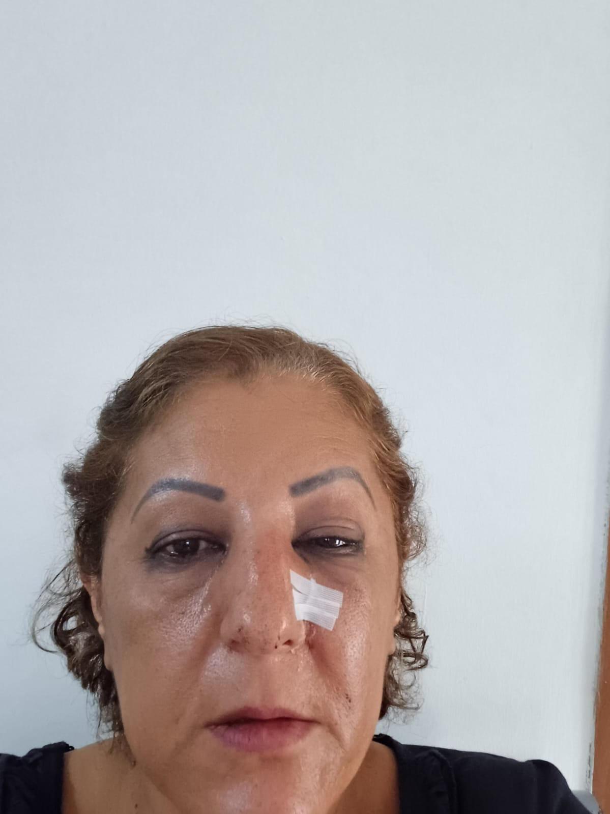 Nihal Aras (49)