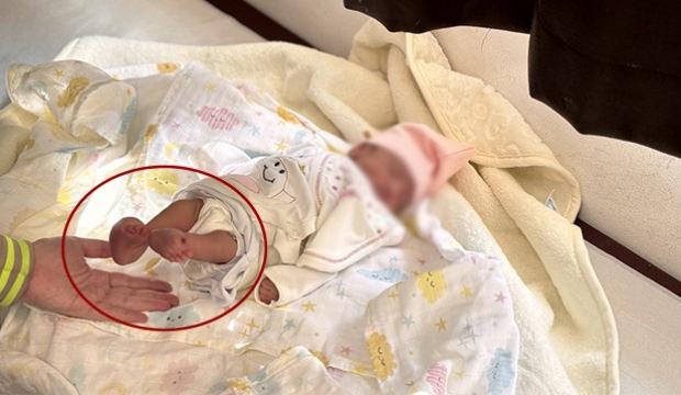Elsiz ve ayaksız doğacaktı! Anne karnında müdahale