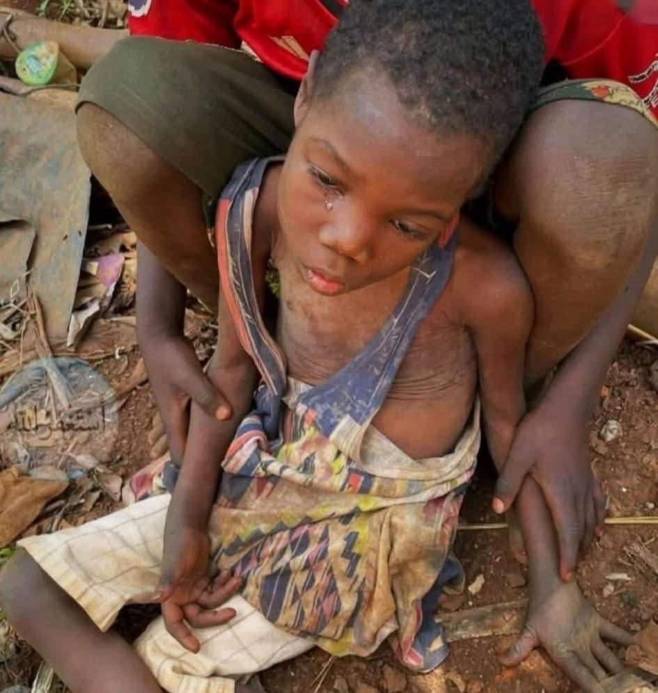 Sudan'da katliamdan en çok çocuklar etkileniyor