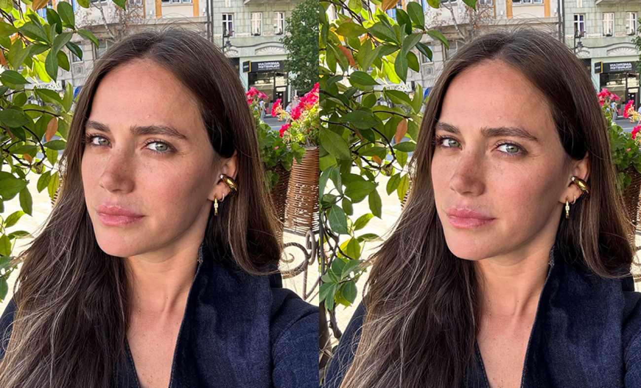 Amerika'da yaşayan Ceyda Ateş sağlık sorununu anlattı! Takipçilerinde yardım istedi