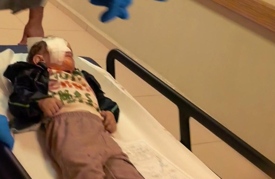 Alpaslan Y.'nin (2) görme yetisini kaybetti. 