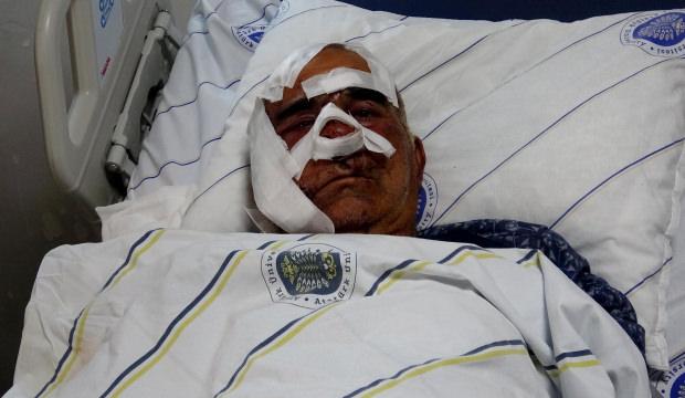 Hayvan otlatırken ayı saldırısına uğradı: Elmacık kemiği koptu! 