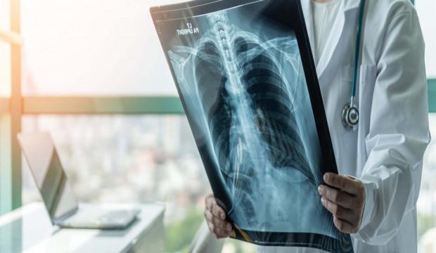 Prof. Dr. Şener 'süperenfeksiyon' için uyardı: ‘Dikkat etmek lazım, ücretsiz aşınızı olun