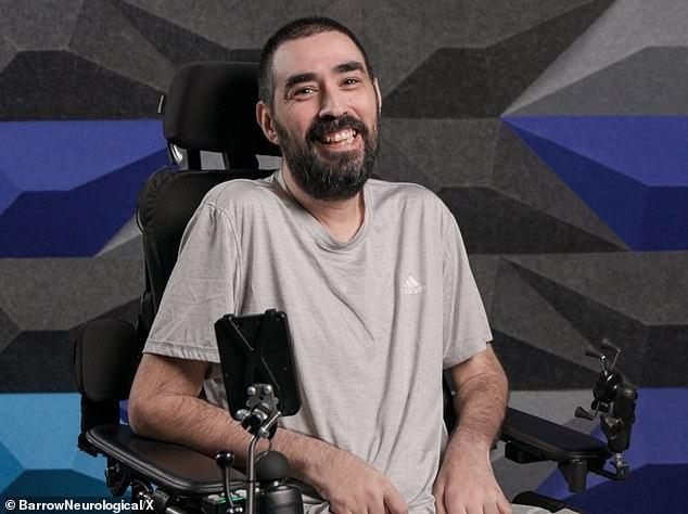 Mike Melgarejo, Neuralink beyin implantını alan dördüncü hastaydı.