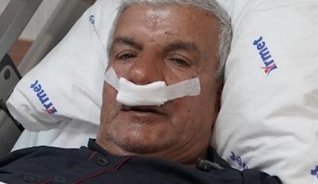 27 yıllık mesleğin şaşırtan sonucu: Burnundan 100 gramlık taş çıktı 