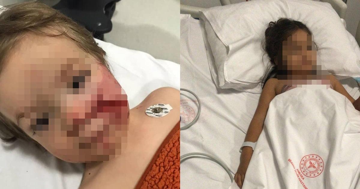 Ankara'da Efe (1,5) ve Doğa Öztürk (5) kardeşlere saldırıp yaralayan pitbull cinsi köpeğin sahibi Tuğçe Ö.E. yakalandı.