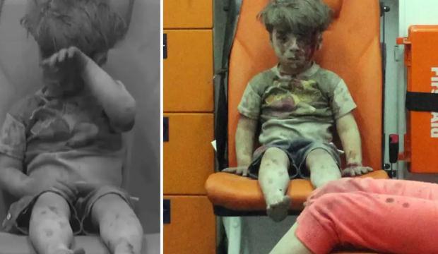 Dünya gündemine oturmuştu! Ümran bebeğin son hali ortaya çıktı!