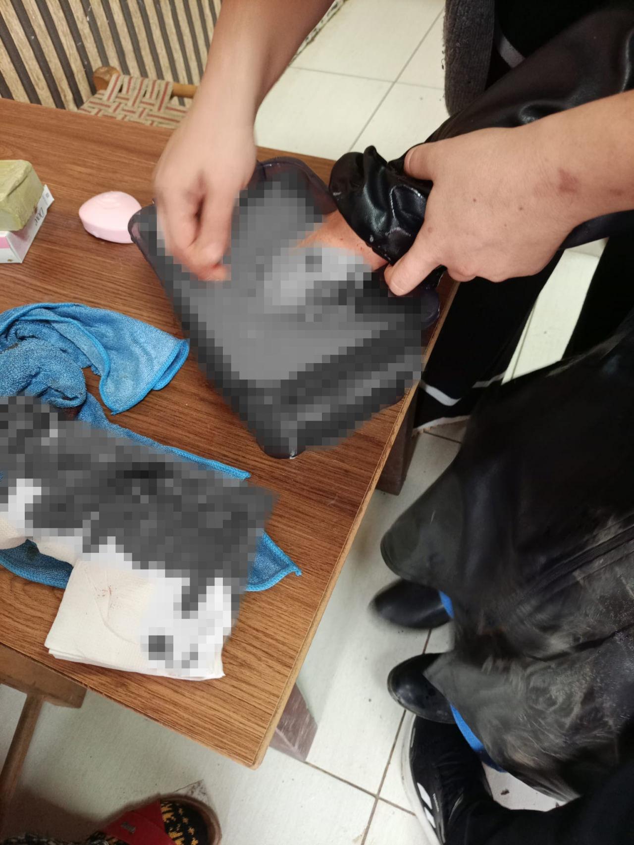 Köpek saldırısı sonucu 2 vatandaş yaralandı.