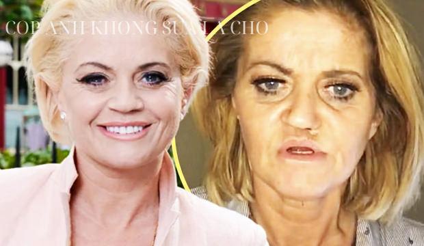 Uyuşturucu &uuml;nl&uuml; yıldızın y&uuml;z&uuml;n&uuml; mahvetti