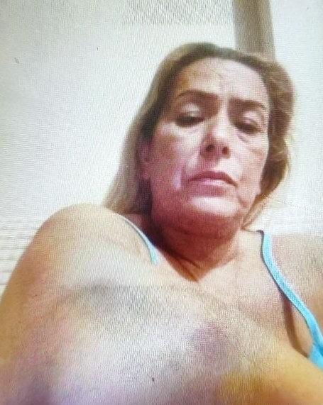 Nevin Vurunbiği (51) babası tarafından darbedildiğini ileri sürdü.