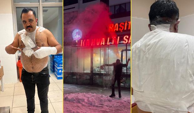 Sivas'ta soğuk hava deneyi hastanede bitti: Meşhur tost&ccedil;u kendini yaktı