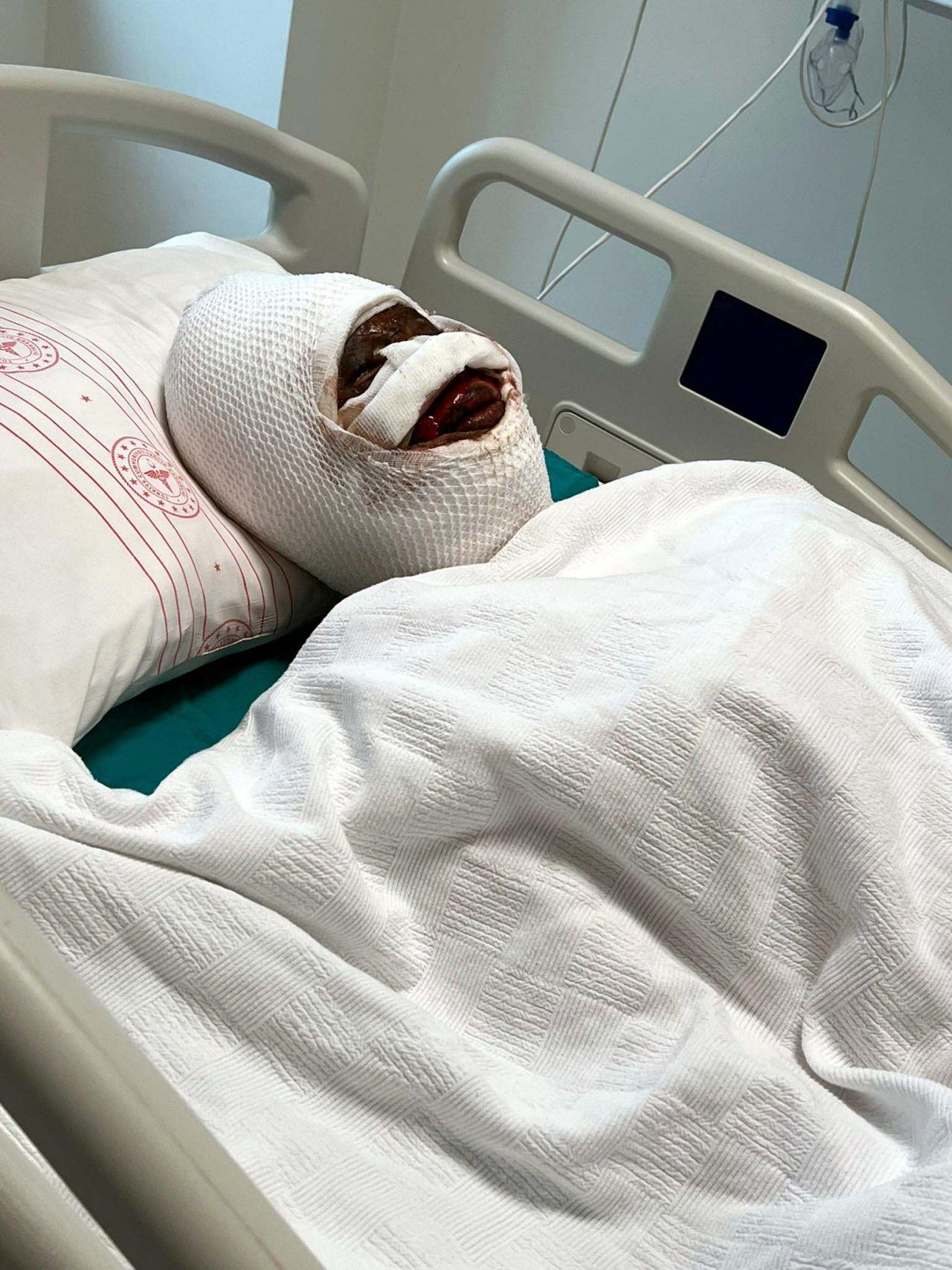 2 çocuk annesi S.Ç son hali. 